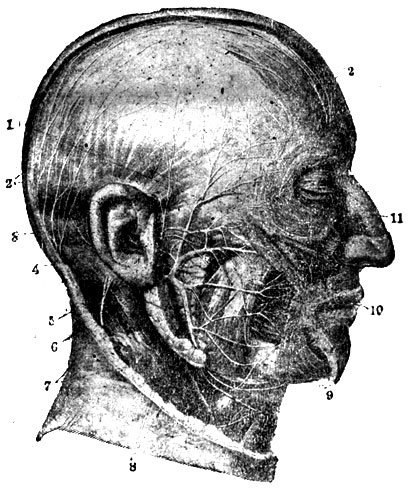  XI.  . I. . 3  , . - 1. Rami temporls. - 2. Ner. occpitales major et minor. - 3. N. auriculares anteriores. - 4. N. auric. n. vagi. - 5. Rami anastomot. cum n. faciali. - 6. N. facialis,  . - 7. N. auricularis magnus. - 8. Plexus rotideus. - 9. Rami buccales. - 10. Rami zigomatici. - 11. Ramus nasalis externus. - 12. Ramus zigomatico-lemporalis